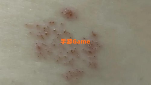 典礼皮缠腰